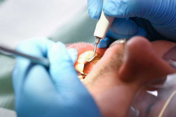 Best Holiday Emergency Dentist in Winona, MS